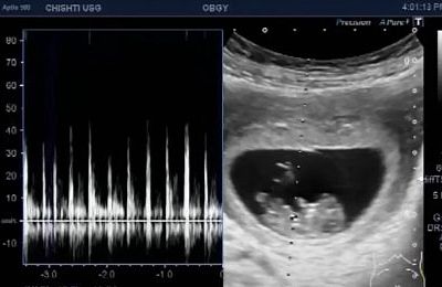 magzat és szívhang